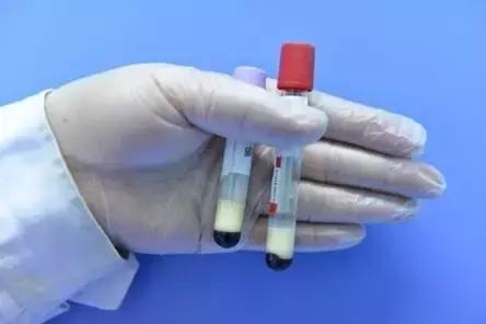 抽血颜色发黑，血液太粘稠了？这3种致病血液，可能都是吃出来的