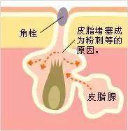毛孔收缩精华和毛孔收敛水,毛孔粗大收缩毛孔最有效的项目