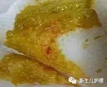新手爸妈｜奶瓣、绿便、腹泻、便秘……宝宝各种便便真图全解必备