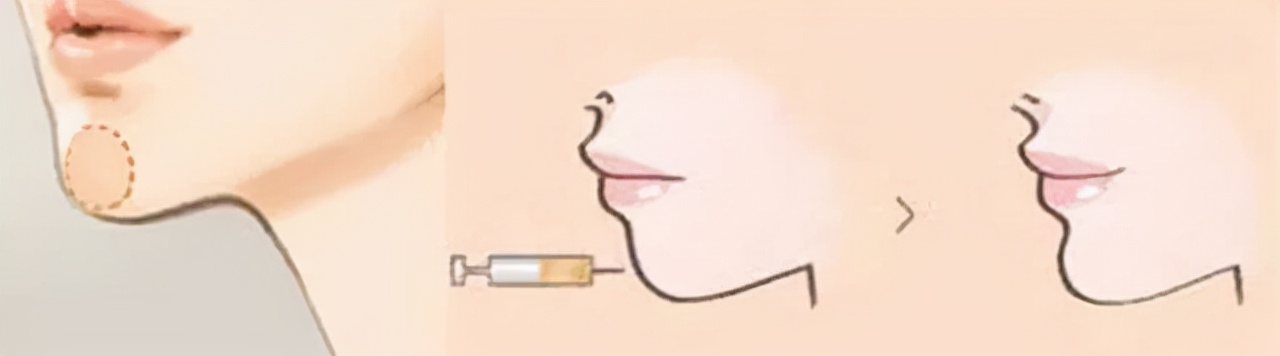 韦敏主任科普,韦敏技术团队科普