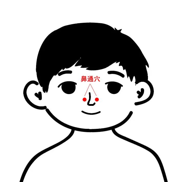 儿童过敏性鼻炎的治疗方法推拿,过敏性鼻炎咳嗽推拿哪些穴位