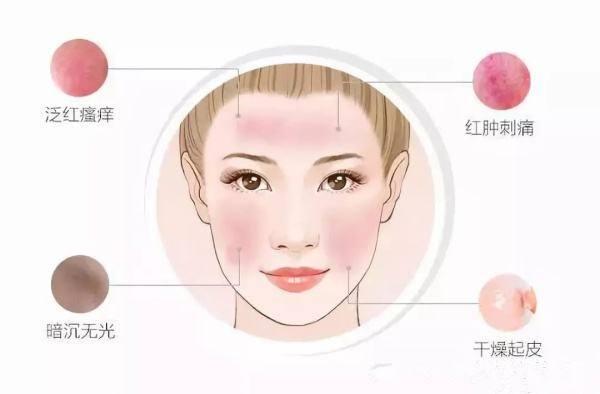 舒淇皮肤过敏,舒淇皮肤过敏化妆
