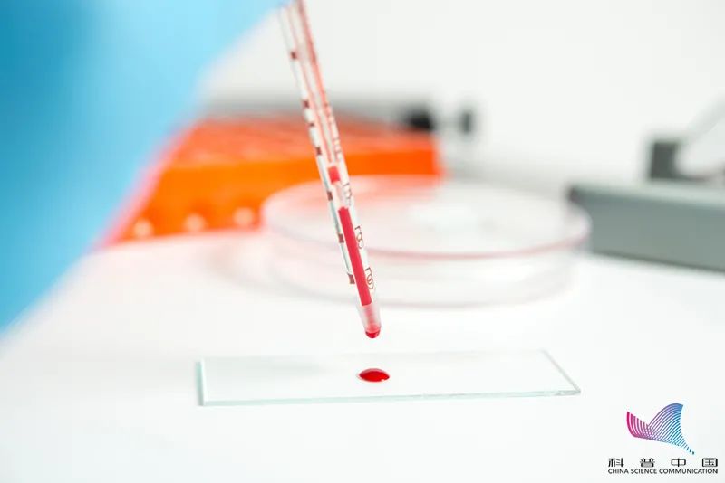 滴血认亲找到10个穿帮,电视中滴血认亲真的科学吗