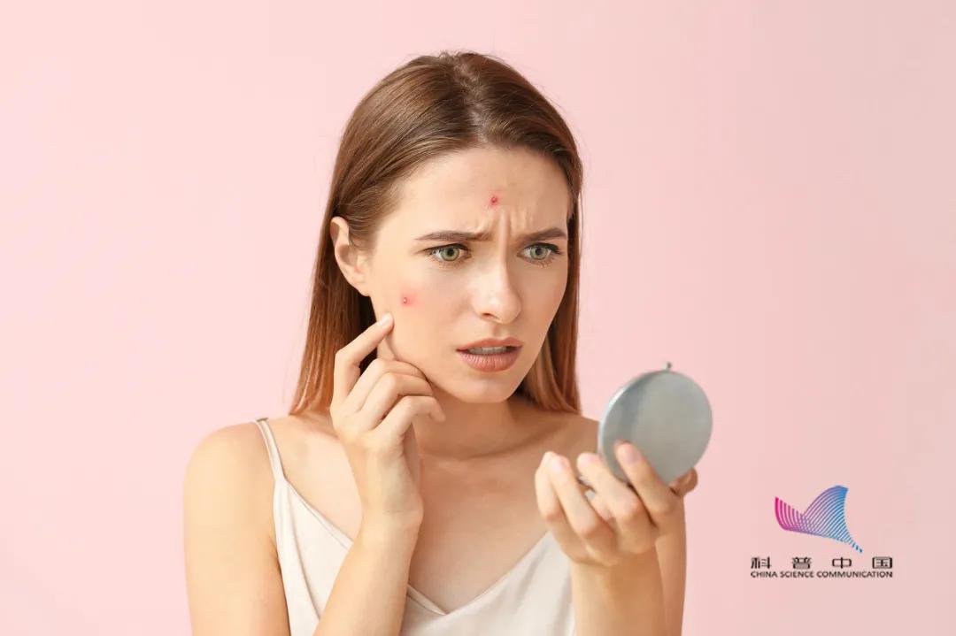 痘痘粉刺反反复复千万别挤,挤了一颗痘毁了整张脸