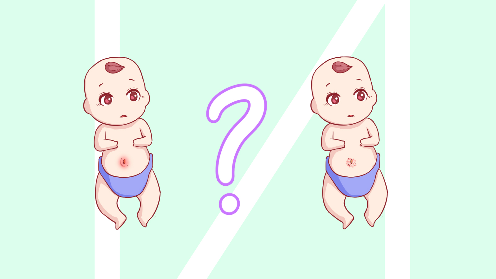 脐周湿疹是什么,婴儿肚脐湿疹和脐炎怎么区分