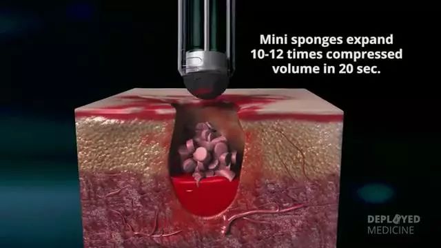 突破传统止血局限：美军战场止血利器X-stat