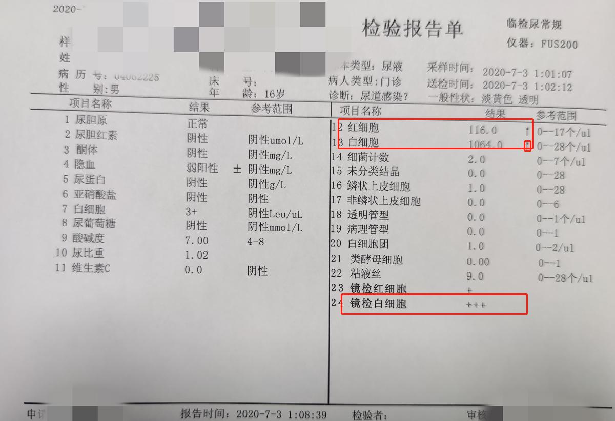 小便黄小便少小便疼是怎么回事,小便发黄并且有疼痛感