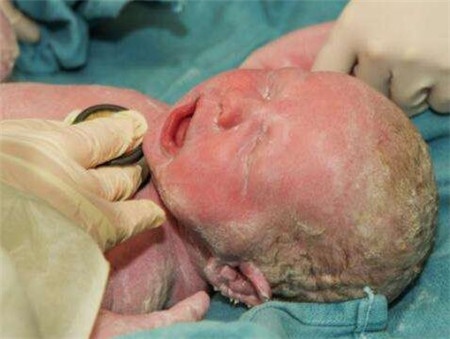 育儿学问：莫把小宝宝的生理现象当病态