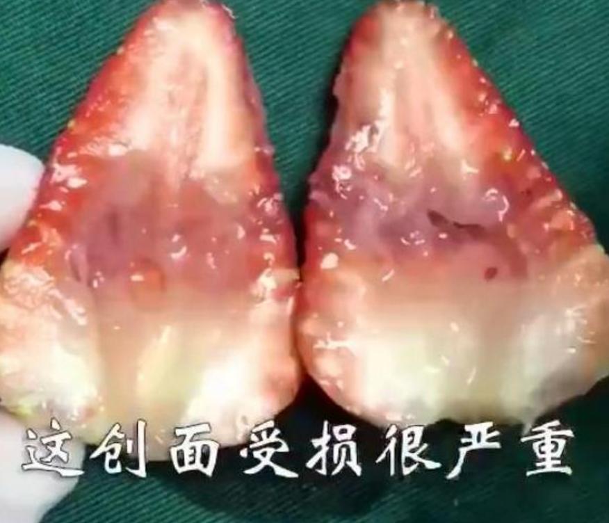 “引产”过程是怎样的？过来人：胎儿有心跳后别打掉，真的很残忍