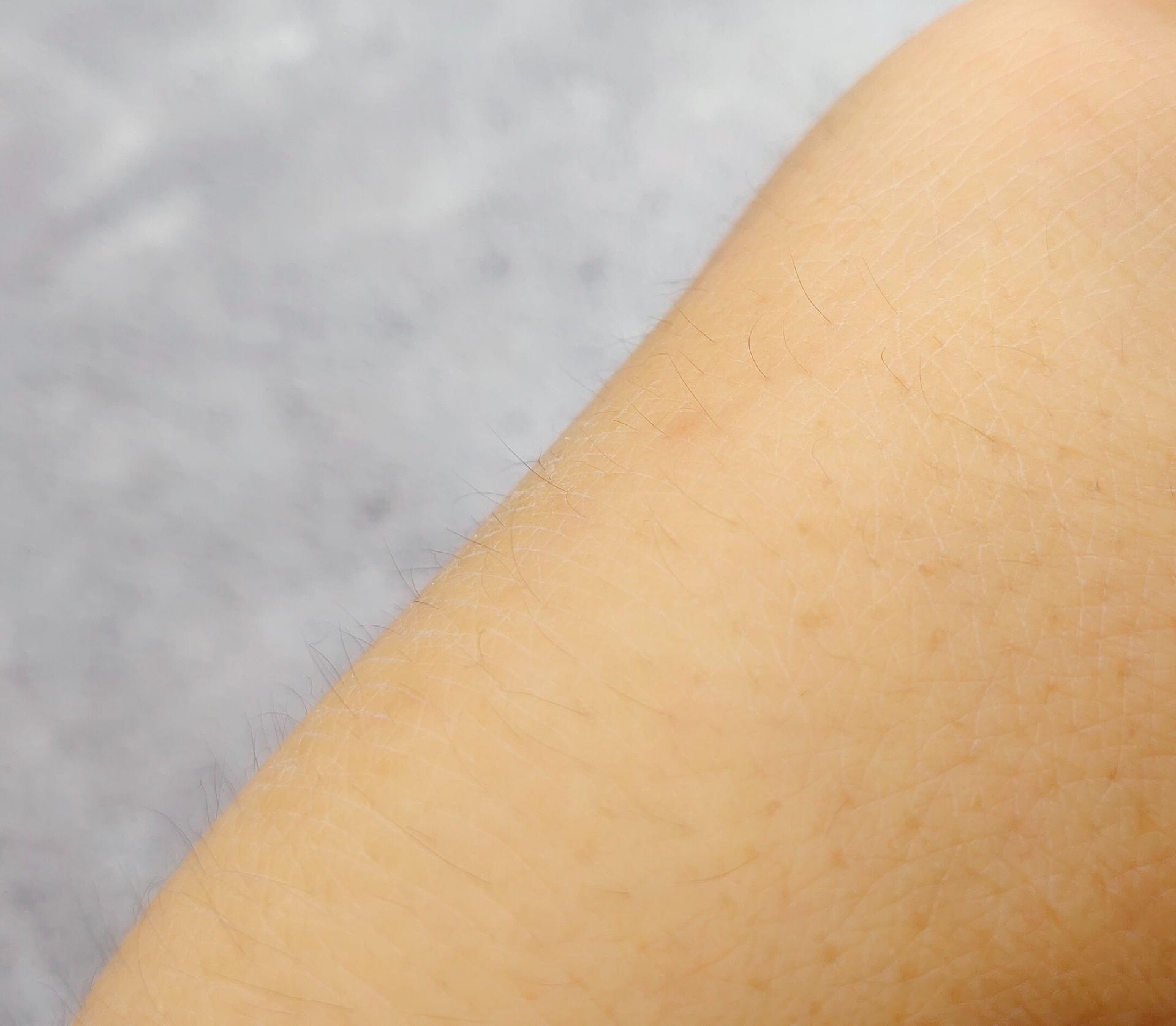 ulike脱毛仪多少钱一台,ulikerose脱毛仪