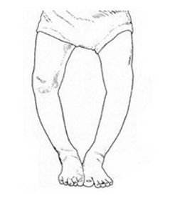 露腿怎么做才能美腿,谁不想拥有一个苗条的身材