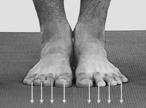 足内翻导致足弓疼,足内翻会导致什么腿型怎么改