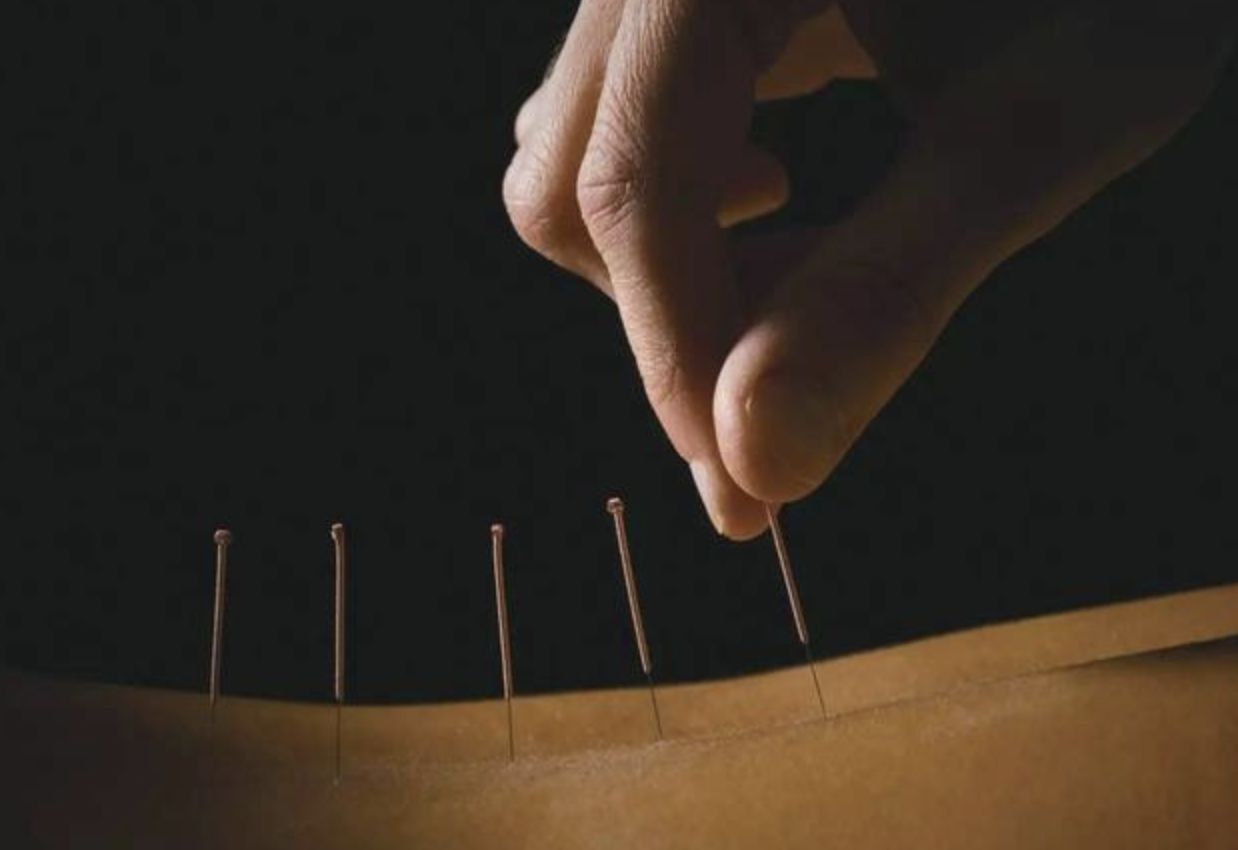 慢性稳定型心绞痛针灸穴位,针灸治心绞痛刺激强度