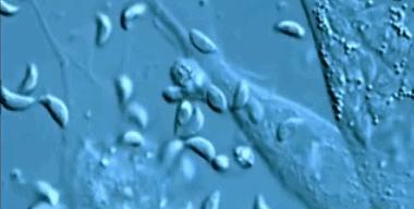 猫咪身上会有弓形虫吗,猫咪身上有没有弓形虫