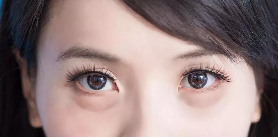 有卧蚕但是笑得不好看,有卧蚕好看还是不好看