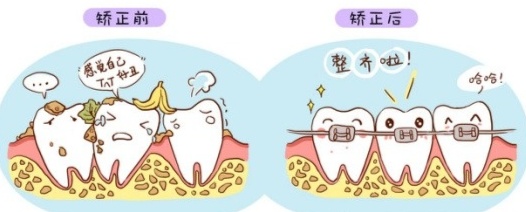 牙齿歪七扭八大小不一能矫正吗,牙齿歪90度是怎么整过来的