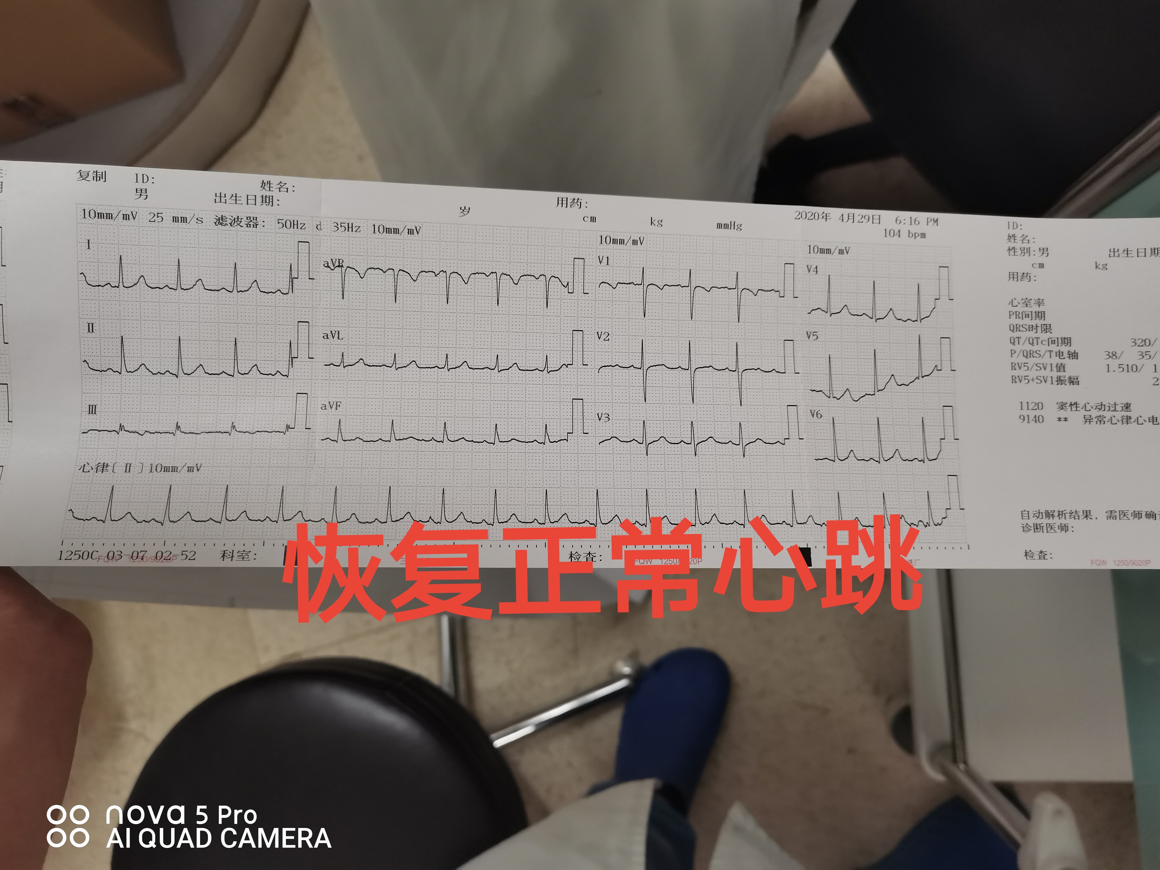 孕妇25周心动过速怎么办,孕28周孕妈心动过速