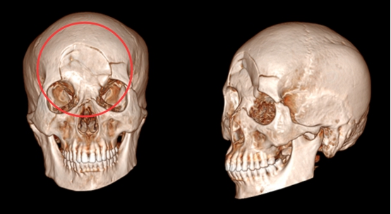 安徽一男子骑车不减速被轿车撞飞,男子开车被陨石砸中