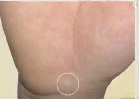 手的10大疾病征兆,手诊10种常见病从手上就能看出来