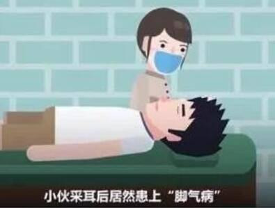 采耳感染脚气,采耳被查出脚气