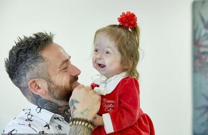 2岁小女孩得了罕见的病视频,2岁女童患罕见绝症