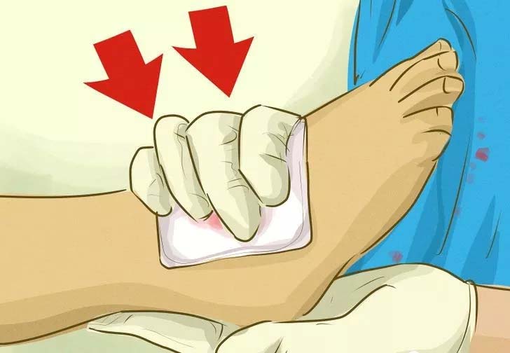 止血用的小妙招,最常用的止血方法