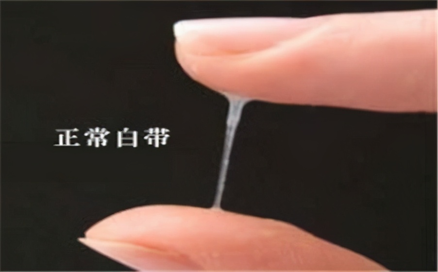 妇科瘙痒白带排不出怎么回事,最近白带多有臭味怎么办