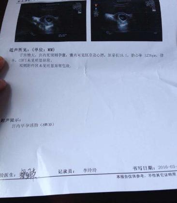 孕早期b超单子怎么看数据,孕早期b超单上怎么看数据