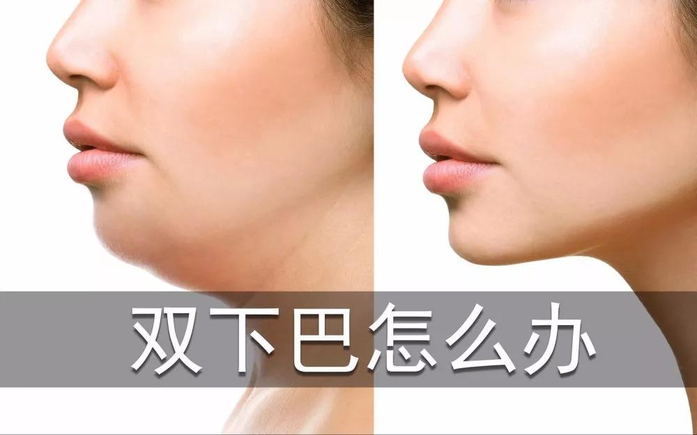 瘦美人的减肥秘诀,男生怎么把双下巴减掉