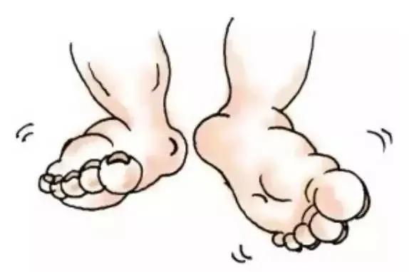 刚开始出现水肿怎么预防,出现水肿用什么药来治疗