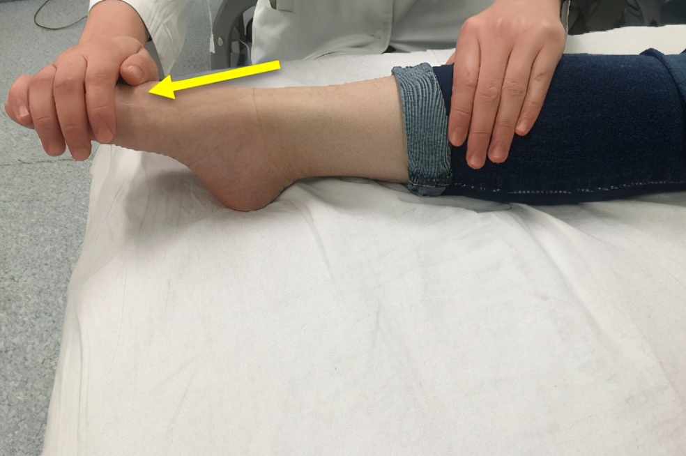 崴脚恢复不好的后遗症怎么治愈,崴脚一般几天就能恢复正常走路