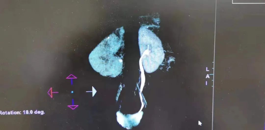患者慕名而来,徐州哪家医院能做体外冲击波碎石