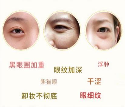 眼部细纹怎么样有效改善,改善眼部细纹的最好方法