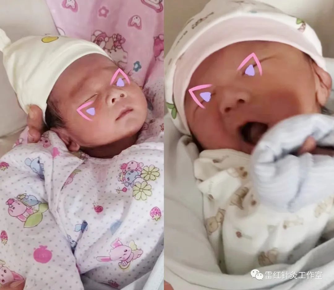 多囊卵巢综合征患者能自然怀孕吗？