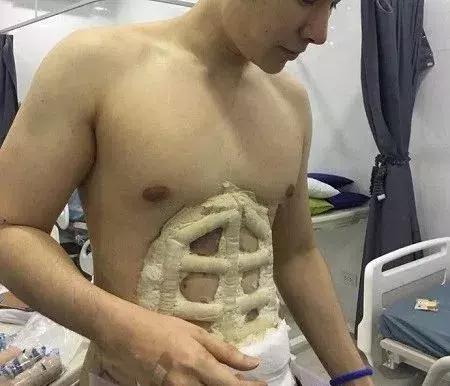 泰国网红花巨资整容30次,泰国网红花费百万整容