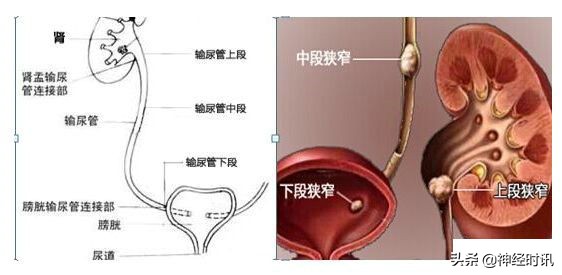肾脏输尿管膀胱前列腺结构,肾输尿管膀胱解剖示意图