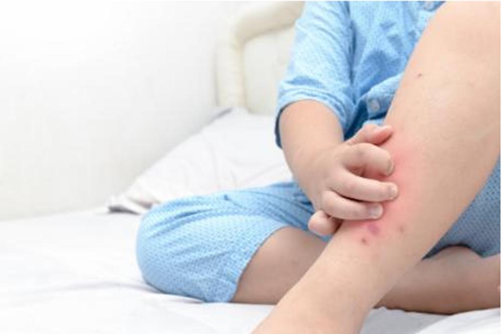宝宝老是被蚊子咬有什么驱蚊方法,宝宝被蚊子叮了红点越来越大