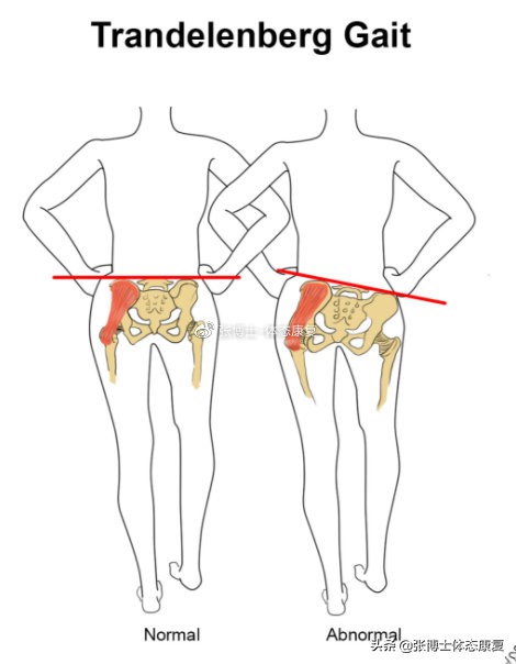 「功能训练」人体额状面稳定性与侧向子系统的关系