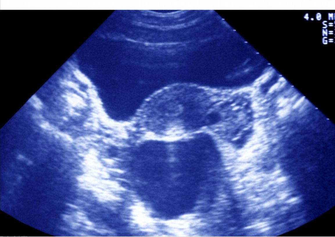 每个医院试管成功率由谁统计的,试管婴儿成功率视频