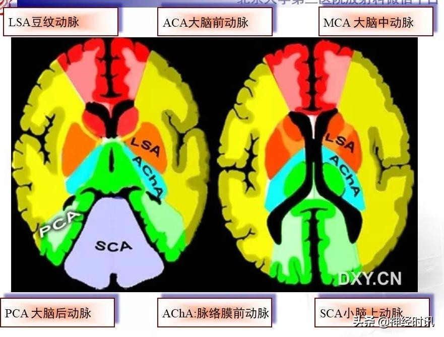 脑动脉解剖学讲解,基底节区脑血管解剖