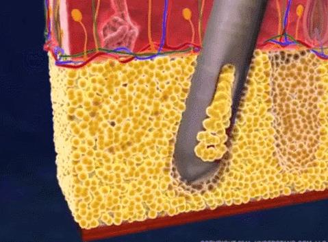 抽脂减肥最佳方法,抽脂后怎么减肥最有效