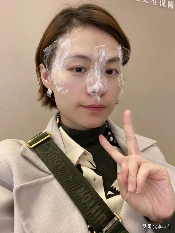 熬夜写完了医美后续，美真的是要付出代价的