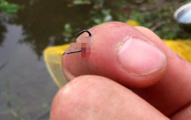 草鱼受伤怎么恢复,10斤草鱼手指受伤