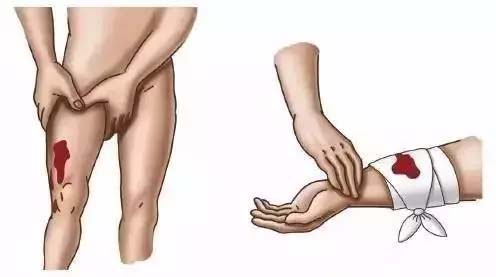 止血用的小妙招,最常用的止血方法