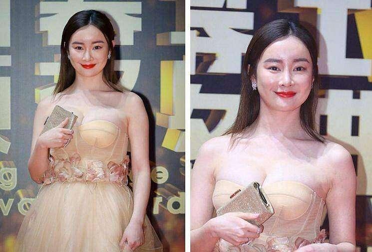 大s讲解玻尿酸,大s代言的玻尿酸