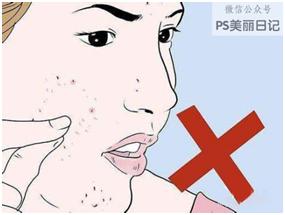 去黑头粉刺最有效的解决方法,如何正确的去黑头粉刺