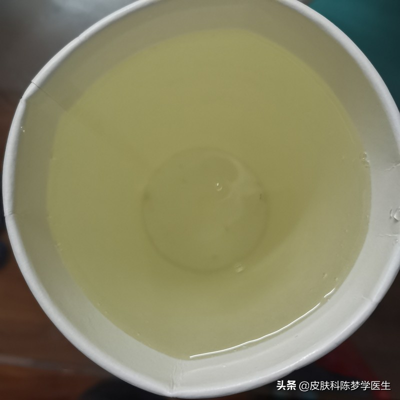 做无痛胃肠镜的真实感受,无痛胃肠镜经历