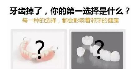 做一颗临时牙教程,自制隐形牙