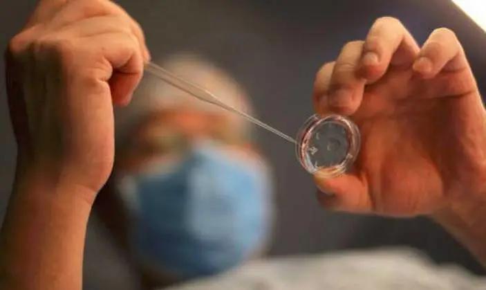 我的卵子这么少，如何抓准时机取到好卵子？