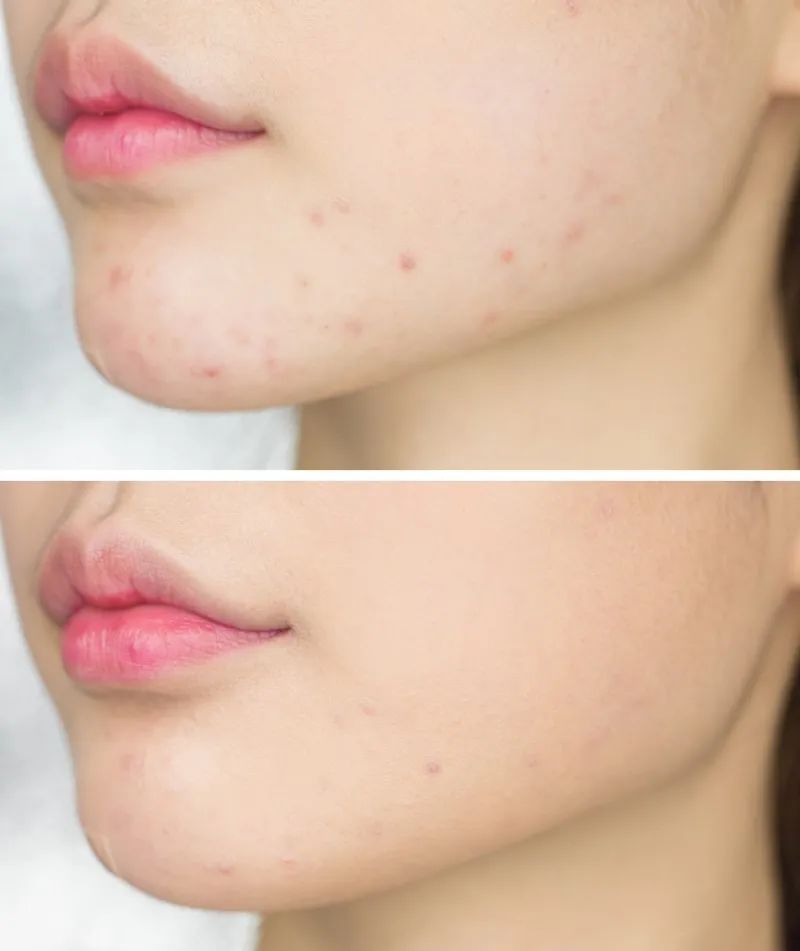 芦荟胶还能这样用?去红维稳,修复肌肤屏障,用完肌肤比豆腐还嫩